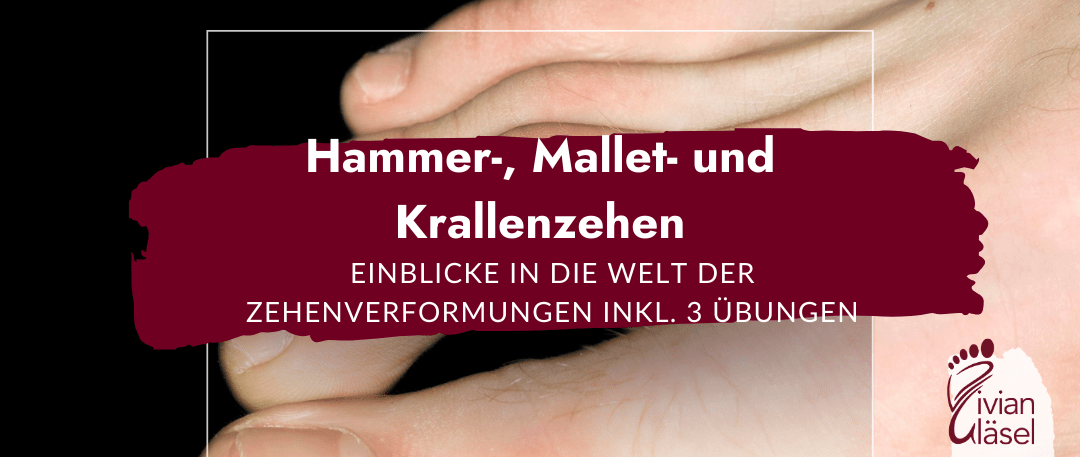 Hammer-, Mallet- und Krallenzehen: Einblicke in die Welt der Zehenverformungen inkl. 3 Übungen