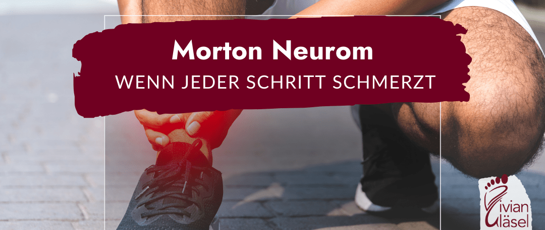 Morton Neuroma: Wenn jeder Schritt schmerzt und der Fuß sich wie durchgetreten anfühlt