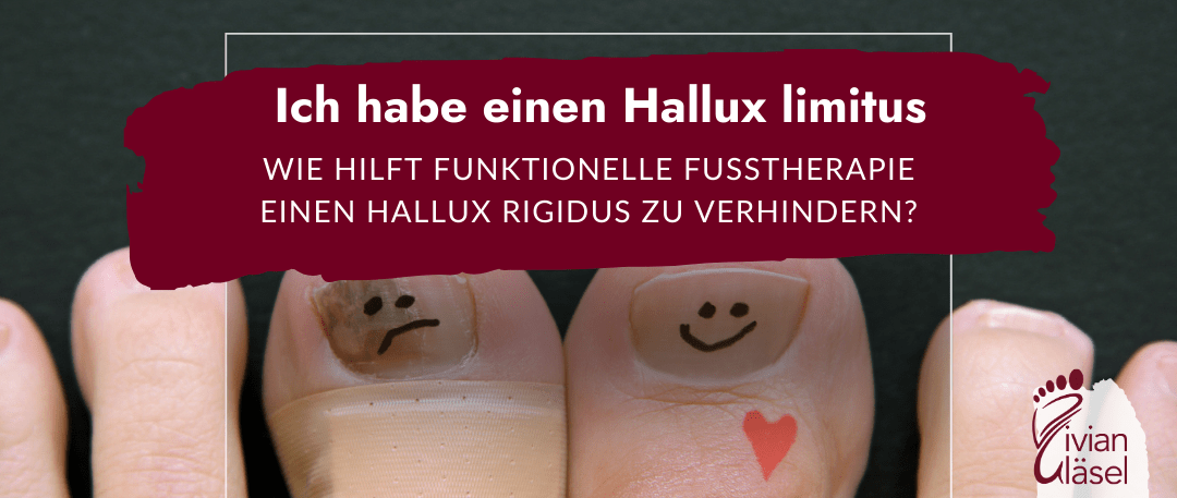 Ich habe einen Hallux limitus: wie hilft funktionelle Fußtherapie einen Hallux rigidus zu verhindern?
