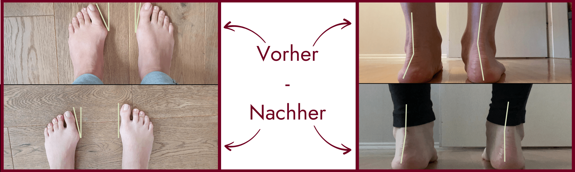 Vorher-Nachher Bild