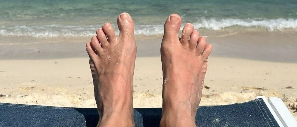 Vivian Glaesel Hallux rigidus