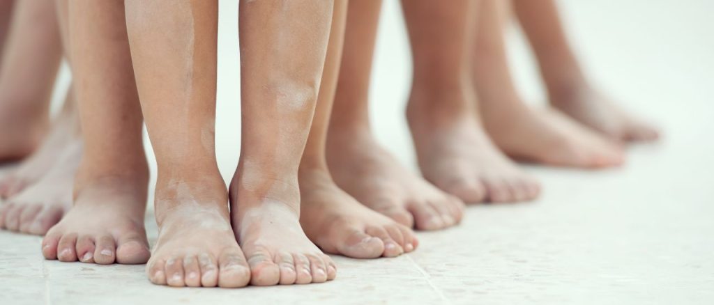 Fußfehlstellungen bei Kindern