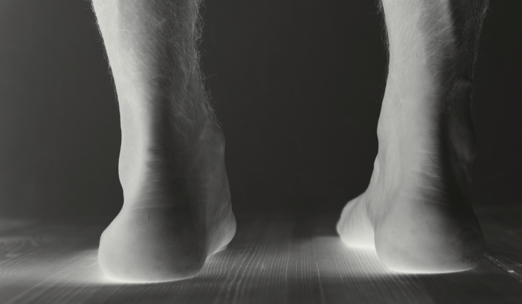 Knick-Senkfuß & Plattfuß Verstehen & Trainieren 1 Knick-Senkfuss & Plattfuss behandeln mit funktioneller Fußtherapie. Das Bild zeigt zwei Füße in Röntgenoptik mit der Diagnose