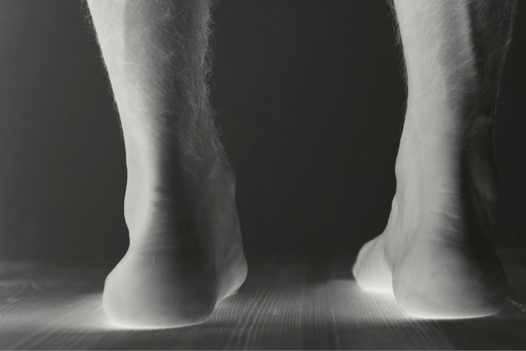 KV Knick Senkfuss 1200x800 1