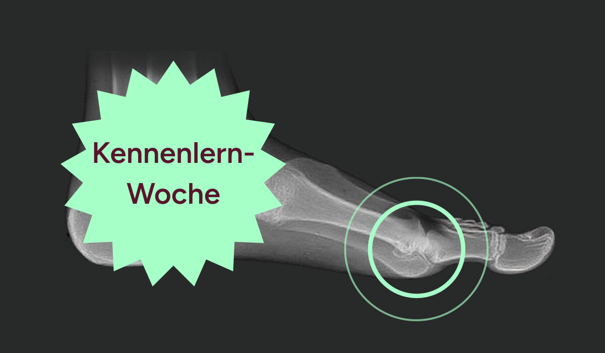 Kennenlern-Woche Hallux rigidus Trainieren 35 Keyvisual KW Hallux rigidus